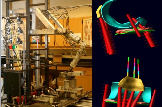 #htmlcaption_1747 Modeling a subject specific Knee model using rigid body dynamics